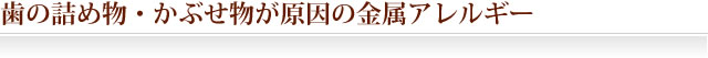 歯の詰め物・かぶせ物が原因の金属アレルギー
