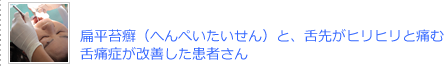 扁平苔癬と、舌先がヒリヒリ痛む舌痛症が改善した患者さん