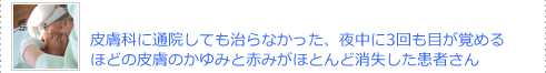 皮膚科に通院しても治らなかった、夜中に３回も目が覚めるほどの皮膚のかゆみと赤みがほとんど消失した患者さん