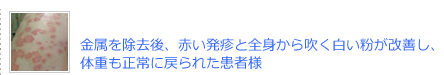 金属を除去後、赤い発疹と全身から吹く白い粉が改善し、体重も正常に戻られた患者様