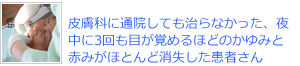 皮膚科に通院しても治らなかった、夜中に3回も目が覚めるほどのかゆみと赤みがほとんど消失した患者さん